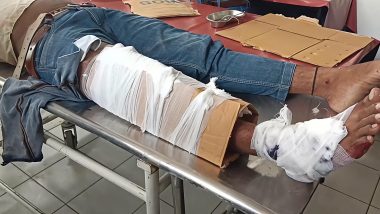 कैमूर : फ्रैक्चर पैर को कार्टून के सहारे बांधकर रेफर करने का वीडियो सामने आया, मोहनिया अनुमंडलीय अस्पताल की व्यवस्था पर उठे सवाल